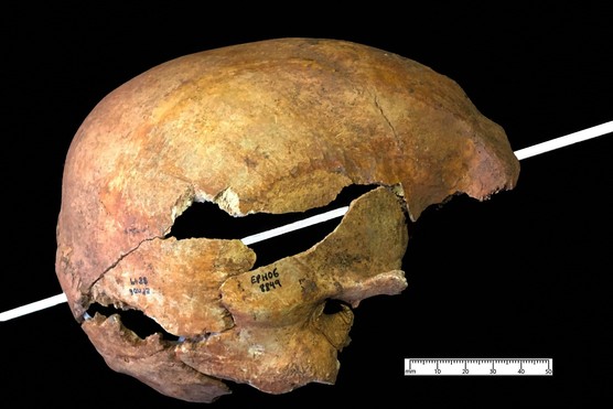 Image of a medieval skull showing arrow injury